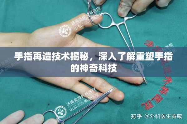 手指再造技术揭秘，深入了解重塑手指的神奇科技