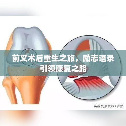 前叉术后重生之旅，励志语录引领康复之路